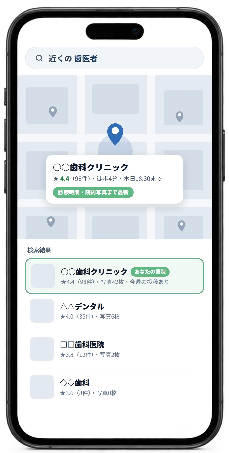 「近くの 歯医者」で検索したときの地図表示のイメージ。自院のピンが目立ち、検索結果の先頭に写真の枚数と口コミ件数が並んでいる